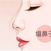 [面相]塌鼻子面相命运如何？这个影响估计很多人都不知道！