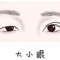 [面相]注意，这些面相的出现是破财的征兆，主动消费可免破财